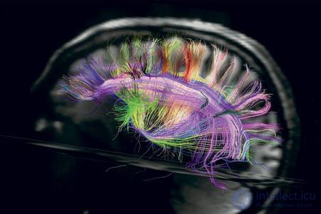   The brain of the car the United States and the European Union to boost research of the brain 