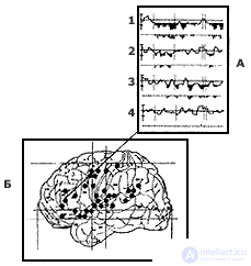 8. PSYCHOPHYSIOLOGY OF VERBAL PROCESSES